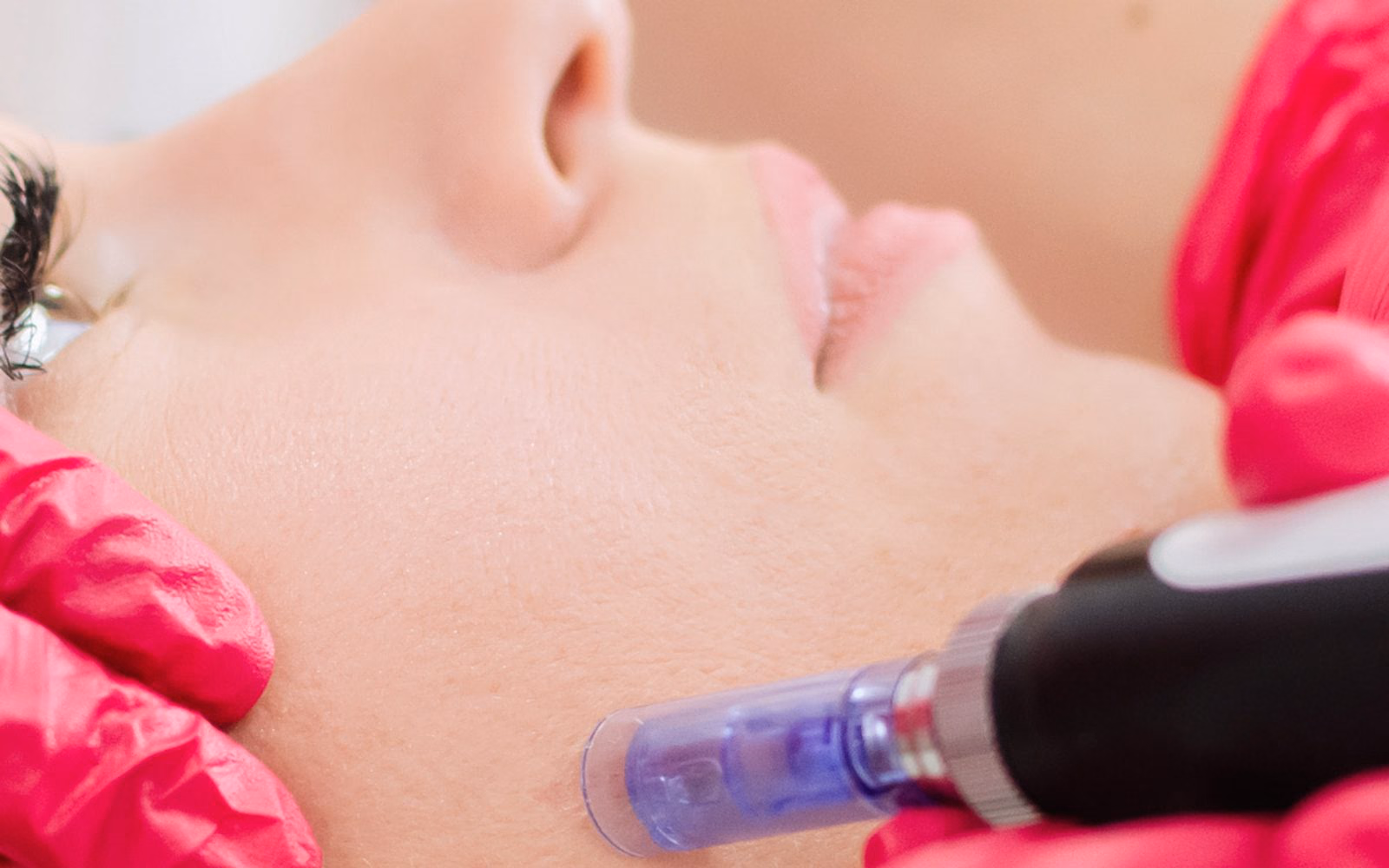 Dermapen