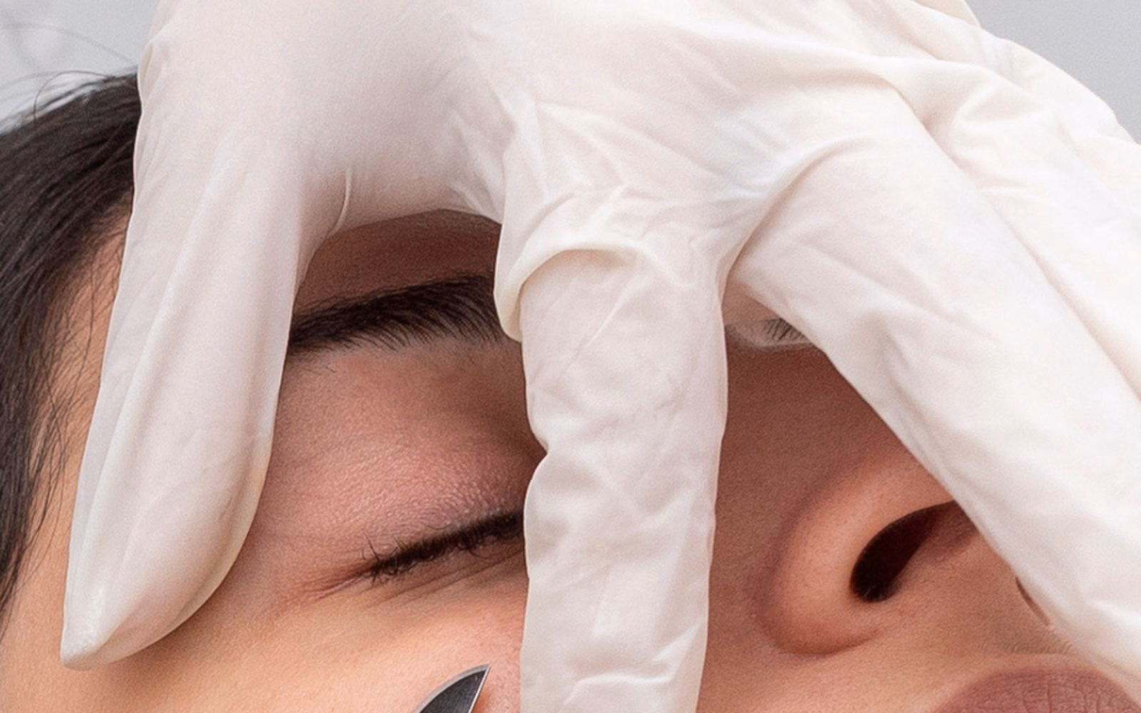 Dermaplaning