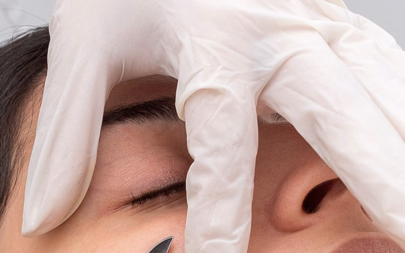 Dermaplaning